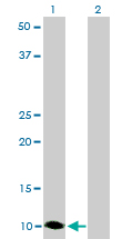 WB - S100A6 Antibody (monoclonal) (M16) AT3760a